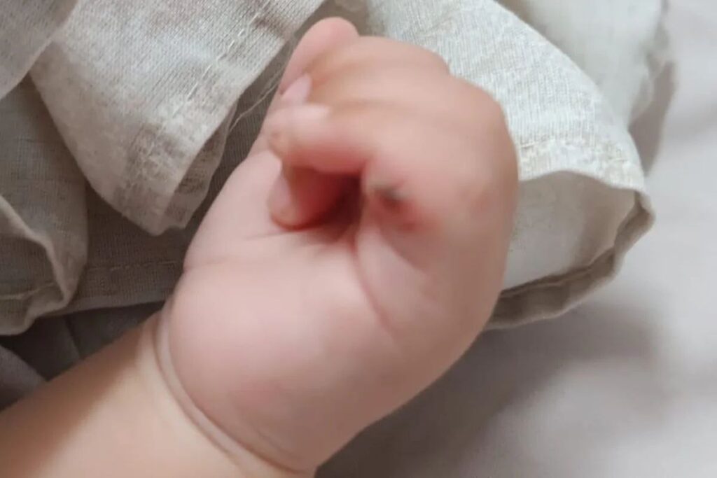 Exagero de família ou falta de noção da profissional?: Médica realiza corte na língua de bebê sem autorização durante cirurgia na mão